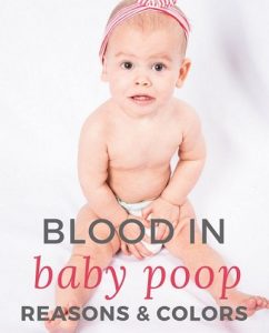 تصویر: http://jarah.clinic/wp-content/uploads/2019/03/ac7ee61505043705a1aecfeb5190d162-baby-tips-baby-care-242x300.jpg
