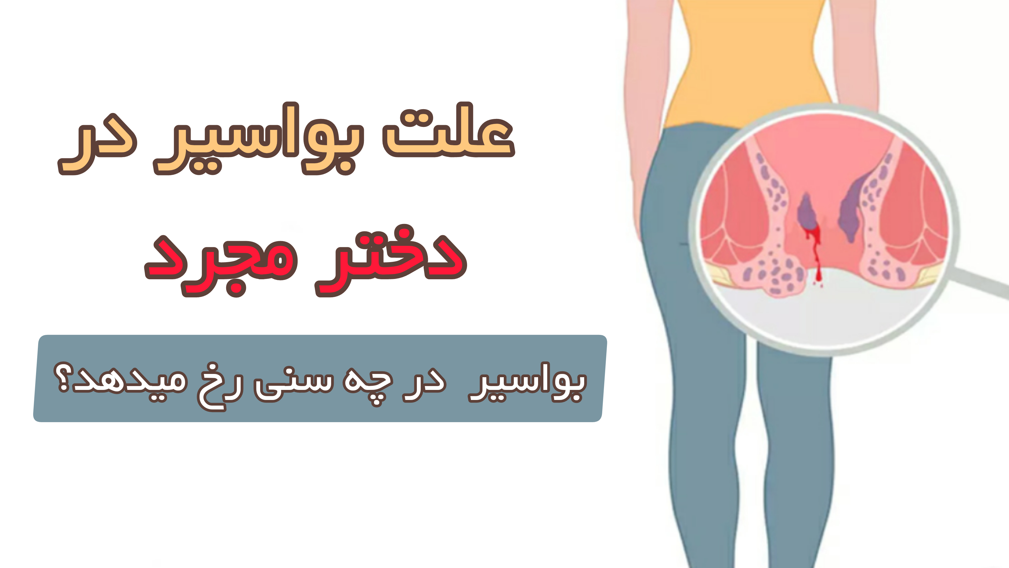 علت بواسیر در دختر مجرد+ بواسیر در چه سنی رخ می دهد؟ | کلینیک نوین