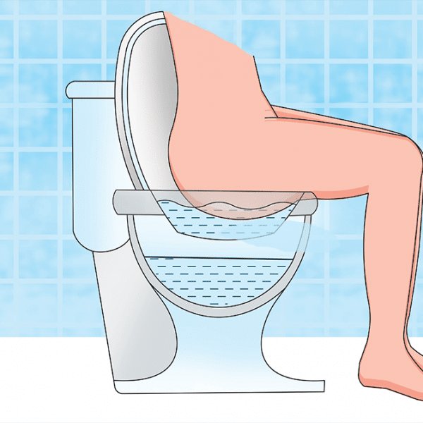 حمام سیتز چیست و تاثیر آن در درمان بواسیر