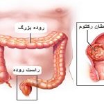 رکتوم