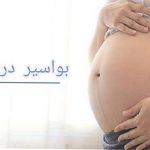 بواسیر در بارداری