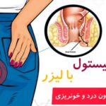 درمان فیستول
